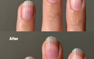 nail care after gel or acrylic removal