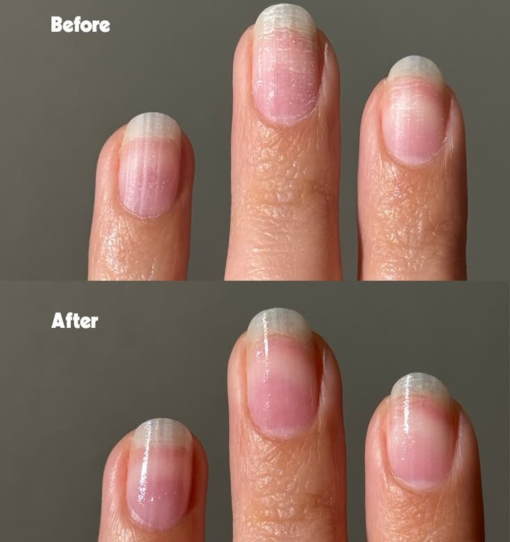 nail care after gel or acrylic removal